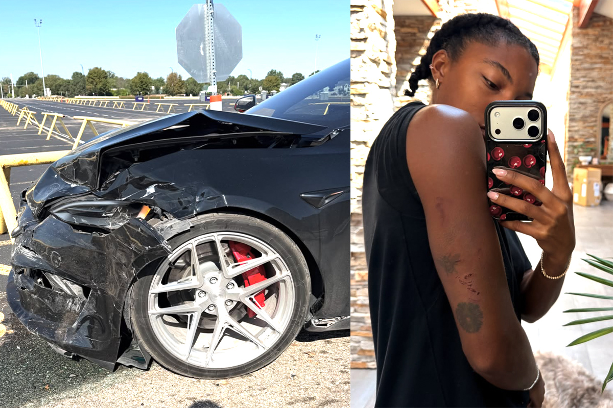 Tara Davis-Woodhall says she suffered a concussion, injuries after car accident